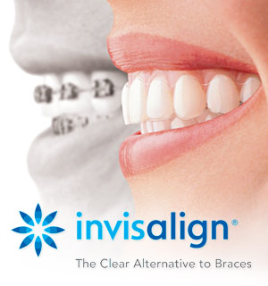 Invisalign logo
