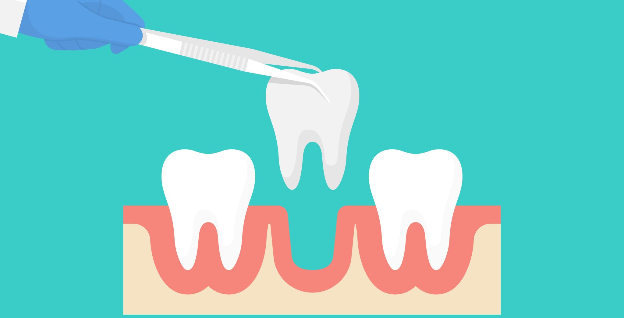 Simple Tooth Extractions In Houston, Tx