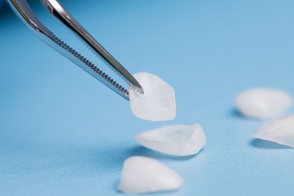 porcelain veneers on blue background